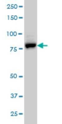 Western Blot: EPS8L2 Antibody (6C2) [H00064787-M01]