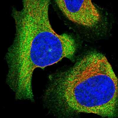 Immunocytochemistry/ Immunofluorescence: EPS8L2 Antibody [NBP1-83613]