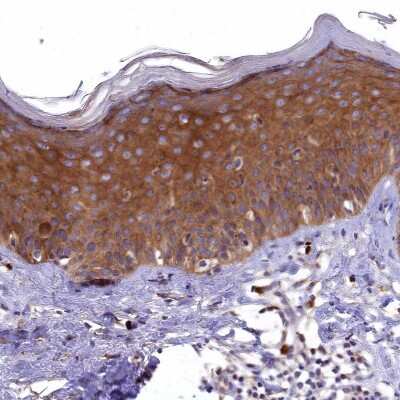 Immunohistochemistry-Paraffin: EPS8L2 Antibody [NBP1-83613]