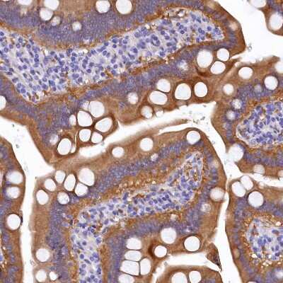 Immunohistochemistry-Paraffin: EPS8L2 Antibody [NBP1-83613]