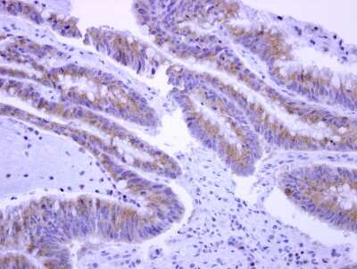 Immunohistochemistry-Paraffin: EPS8L2 Antibody [NBP2-16357]