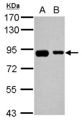 Western Blot: EPS8L2 Antibody [NBP2-16357]
