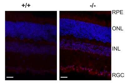 Immunohistochemistry: ER Stress / UPR Antibody Pack [NBP2-52746]