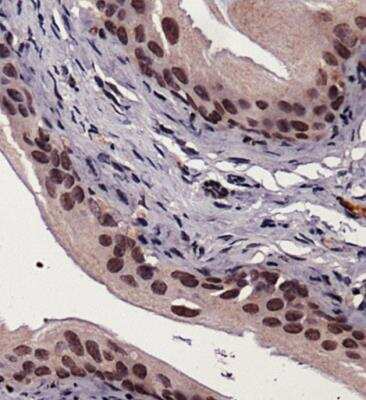 Immunohistochemistry-Paraffin: ER Stress / UPR Antibody Pack [NBP2-52746]