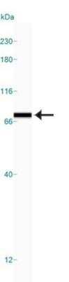 Simple Western: ER Stress / UPR Antibody Pack [NBP2-52746]