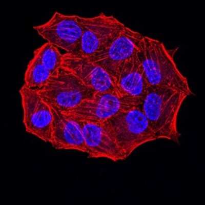 Immunocytochemistry/ Immunofluorescence: ER alpha/NR3A1 Antibody (6A6E8) - BSA Free [NBP2-61764]