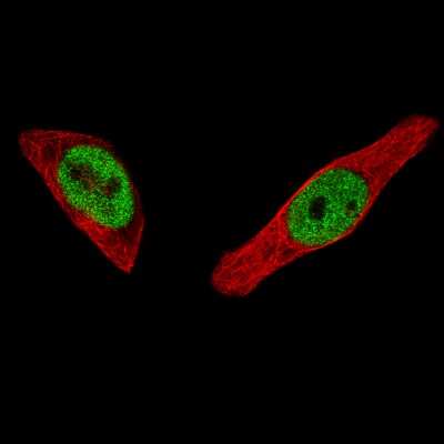 Immunocytochemistry/ Immunofluorescence: ER alpha/NR3A1 Antibody (CL1196) [NBP2-34478]
