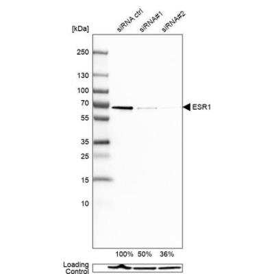 Western Blot: ER alpha/NR3A1 Antibody (CL1196) [NBP2-34478]