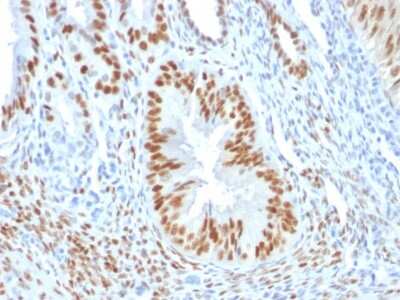 Immunohistochemistry-Paraffin: ER alpha/NR3A1 Antibody (ER506) [NBP2-33320]