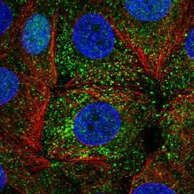 Immunocytochemistry/ Immunofluorescence: ER alpha/NR3A1 Antibody [NBP1-84827]