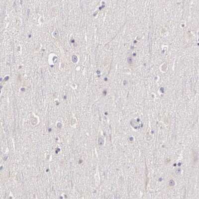 Immunohistochemistry-Paraffin: ER alpha/NR3A1 Antibody [NBP1-84826]