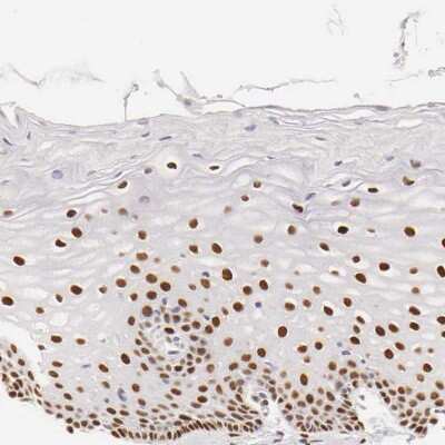Immunohistochemistry-Paraffin: ER alpha/NR3A1 Antibody [NBP1-84827]