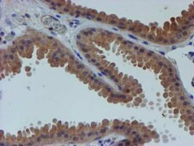Immunohistochemistry: ER alpha/NR3A1 Antibody (OTI1B1) - Azide and BSA Free [NBP2-70687]