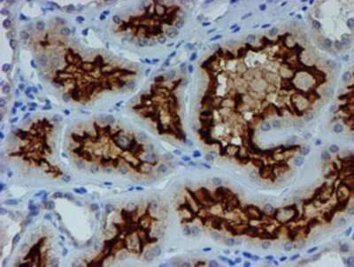 Immunohistochemistry: ER alpha/NR3A1 Antibody (OTI1B1) - Azide and BSA Free [NBP2-70687]