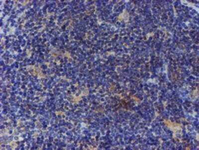 Immunohistochemistry: ER alpha/NR3A1 Antibody (OTI1B1) - Azide and BSA Free [NBP2-70687]
