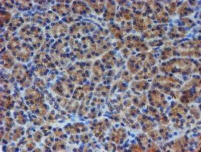 Immunohistochemistry: ER alpha/NR3A1 Antibody (OTI1B1) - Azide and BSA Free [NBP2-70687]