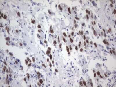 Immunohistochemistry: ER alpha/NR3A1 Antibody (OTI2D3) - Azide and BSA Free [NBP2-70688]