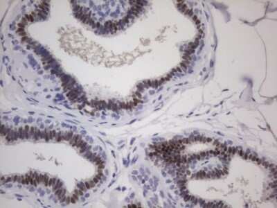 Immunohistochemistry: ER alpha/NR3A1 Antibody (OTI2D3) - Azide and BSA Free [NBP2-70688]