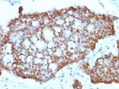 Immunohistochemistry-Paraffin: ER beta/NR3A2 Antibody (ERb455) - Azide and BSA Free [NBP2-33066]