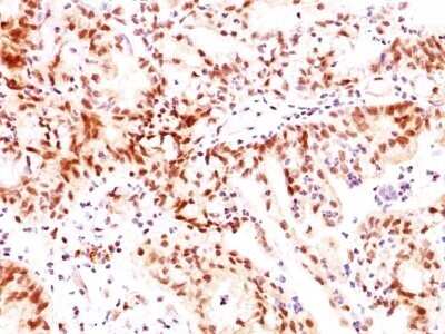 Immunohistochemistry-Paraffin: ER beta/NR3A2 Antibody (ERb455) - Azide and BSA Free [NBP2-33066]
