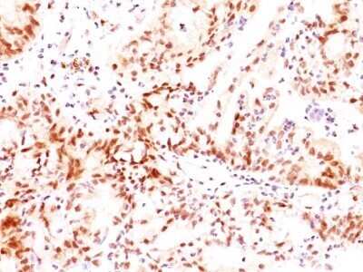 Immunohistochemistry-Paraffin: ER beta/NR3A2 Antibody (ERb455) - Azide and BSA Free [NBP2-33066]