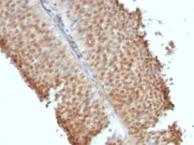 Immunohistochemistry-Paraffin: ER beta/NR3A2 Antibody (ERb455) - IHC-Prediluted [NBP2-44365]