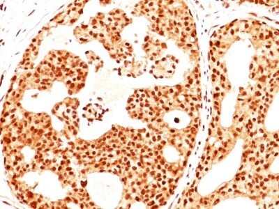 Immunohistochemistry-Paraffin: ER beta/NR3A2 Antibody (ERb455) - IHC-Prediluted [NBP2-44365]