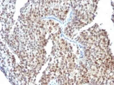 Immunohistochemistry-Paraffin: ER beta/NR3A2 Antibody (ESR2/686) - Azide and BSA Free [NBP2-47797]