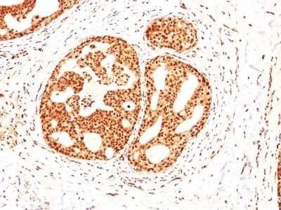 Immunohistochemistry-Paraffin: ER beta/NR3A2 Antibody (ESR2/686) - Azide and BSA Free [NBP2-47797]