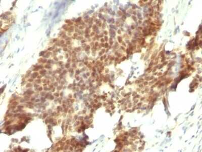 Immunohistochemistry-Paraffin: ER beta/NR3A2 Antibody (ESR2/686) [NBP2-44366]