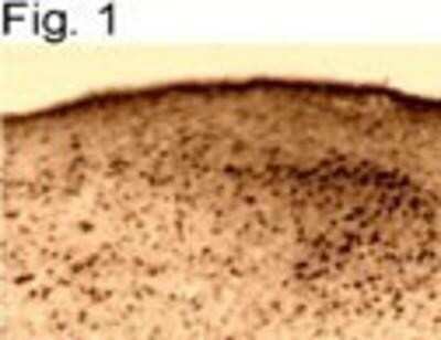 Immunohistochemistry-Paraffin: ER beta/NR3A2 Antibody [NB120-3577]