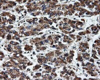 Immunohistochemistry: ERAB Antibody (OTI10B4) - Azide and BSA Free [NBP2-70871]