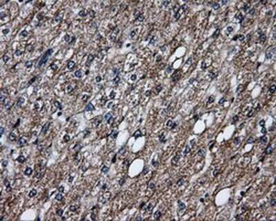 Immunohistochemistry: ERAB Antibody (OTI10B4) - Azide and BSA Free [NBP2-70871]