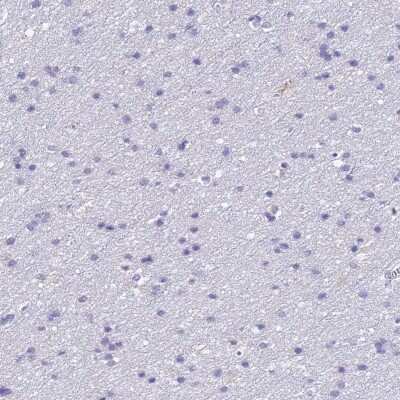 Immunohistochemistry-Paraffin: ERAF Antibody [NBP1-84008]