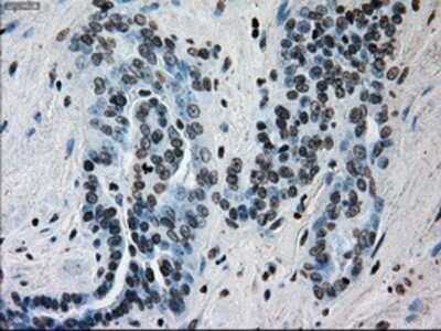 Immunohistochemistry: ERCC1 Antibody (OTI1A3) - Azide and BSA Free [NBP2-70662]
