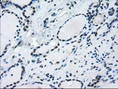 Immunohistochemistry: ERCC1 Antibody (OTI1A3) - Azide and BSA Free [NBP2-70662]