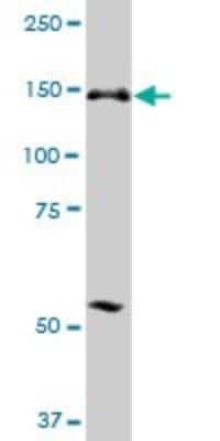 Western Blot: ERCC6L Antibody [H00054821-B01P]