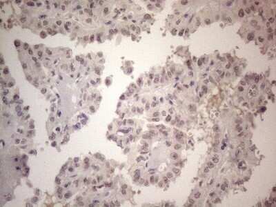 Immunohistochemistry: ERCC8 Antibody (OTI2G1) - Azide and BSA Free [NBP2-70412]