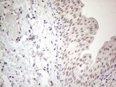 Immunohistochemistry: ERCC8 Antibody (OTI2G1) - Azide and BSA Free [NBP2-70412]