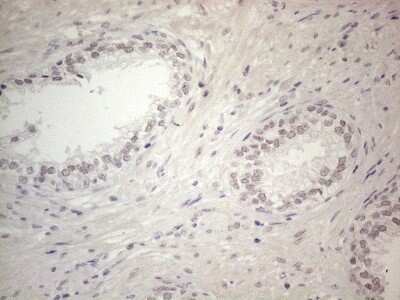 Immunohistochemistry: ERCC8 Antibody (OTI2G1) - Azide and BSA Free [NBP2-70412]