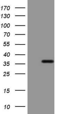 Western Blot: ERCC8 Antibody (OTI2G1)Azide and BSA Free [NBP2-70412]