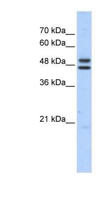 Western Blot: ERCC8 Antibody [NBP1-54898]