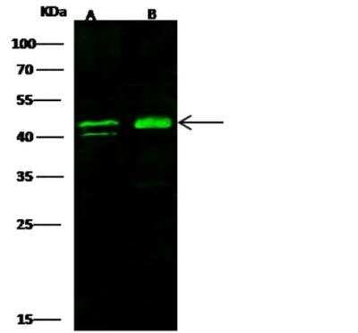 Western Blot: ERCC8 Antibody [NBP2-98792]