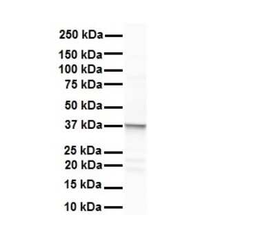 Western Blot: ERCC8 Antibody [NBP3-10907]