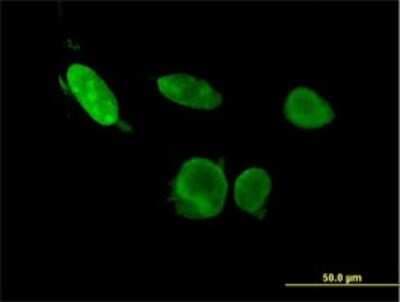 Immunocytochemistry/ Immunofluorescence: ERF Antibody (3F11) [H00002077-M02]