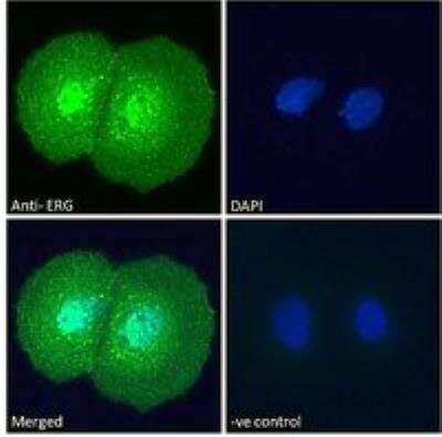Immunocytochemistry/ Immunofluorescence: ERG Antibody [NB100-2472]