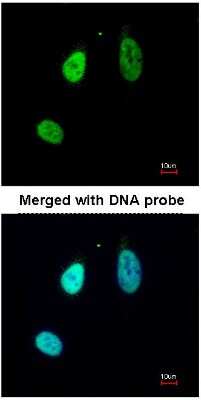 Immunocytochemistry/ Immunofluorescence: ERG Antibody [NBP1-31370]