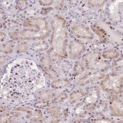 Immunohistochemistry: ERG Antibody [NBP2-38555]