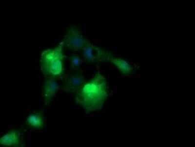 Immunocytochemistry/ Immunofluorescence: ERG Antibody (OTI4H7) - Azide and BSA Free [NBP2-70686]