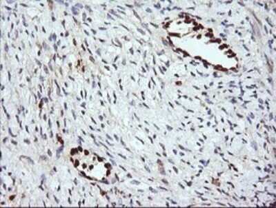Immunohistochemistry: ERG Antibody (OTI4H7) - Azide and BSA Free [NBP2-70686]